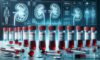 Kidney Blood Test: A Comprehensive Guide for Blackburn Residents
