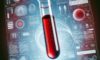 Vitamin B12 Blood Test: Essential Guide for Bridlington Residents