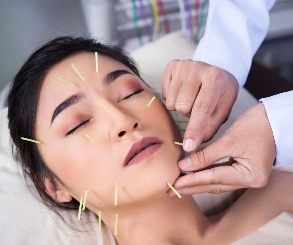 Cosmetic Acupuncture: Essential Disadvantages to Know
